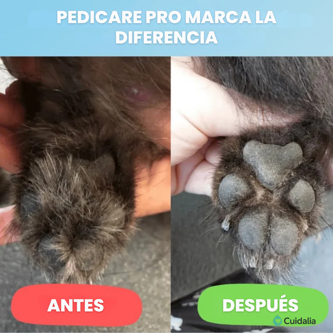 Cortapelos de precisión PediCare Pro™